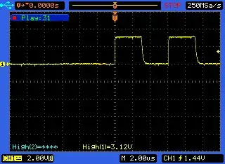 Leading pulse absent
