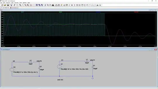 ECG