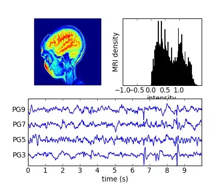 MRI with EEG1